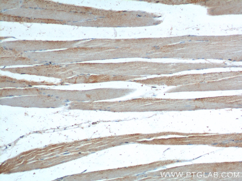 IHC staining of human skeletal muscle using 20807-1-AP