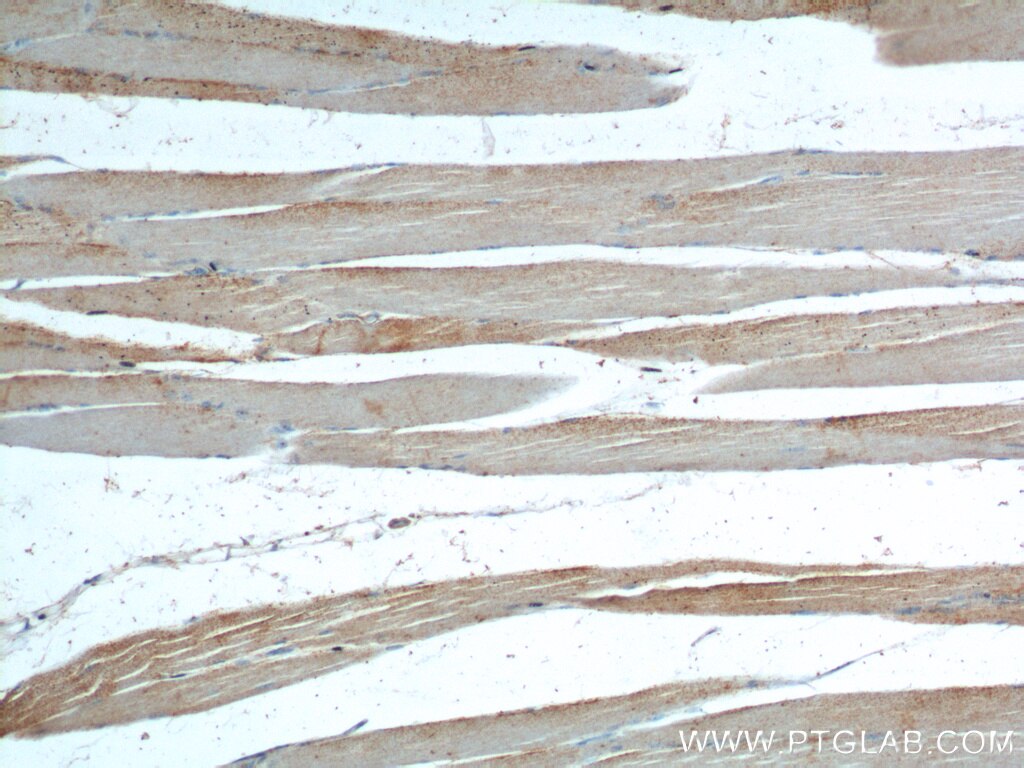 Immunohistochemistry (IHC) staining of human skeletal muscle tissue using neuron navigator 1 Polyclonal antibody (20807-1-AP)