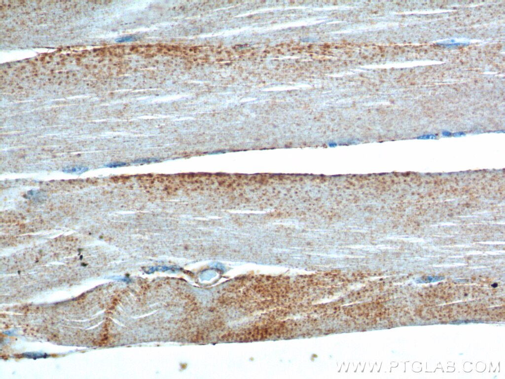 IHC staining of human skeletal muscle using 20807-1-AP