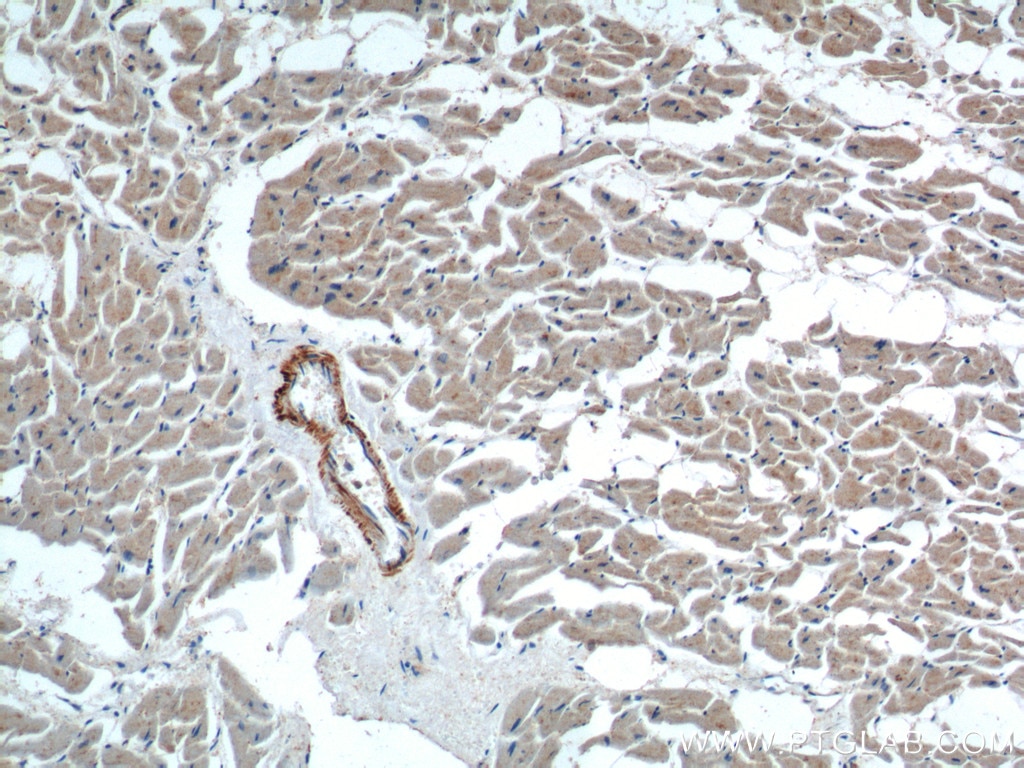 Immunohistochemistry (IHC) staining of human heart tissue using neuron navigator 1 Polyclonal antibody (20807-1-AP)
