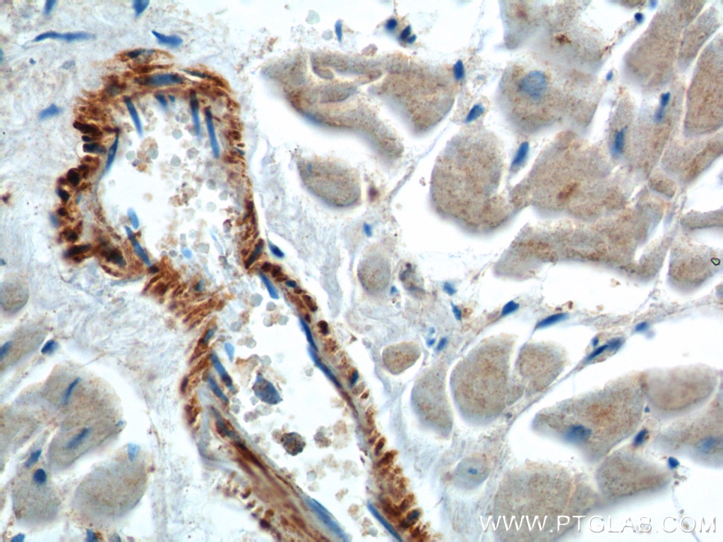 Immunohistochemistry (IHC) staining of human heart tissue using neuron navigator 1 Polyclonal antibody (20807-1-AP)