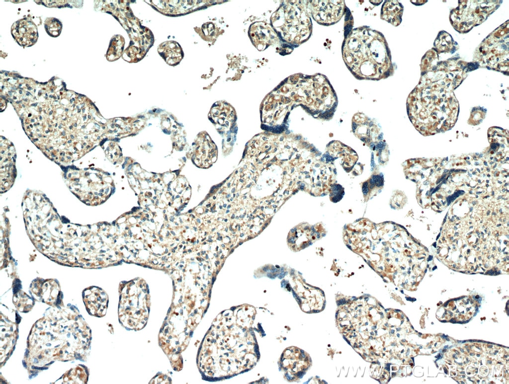 Immunohistochemistry (IHC) staining of human placenta tissue using neuron navigator 1 Polyclonal antibody (20807-1-AP)