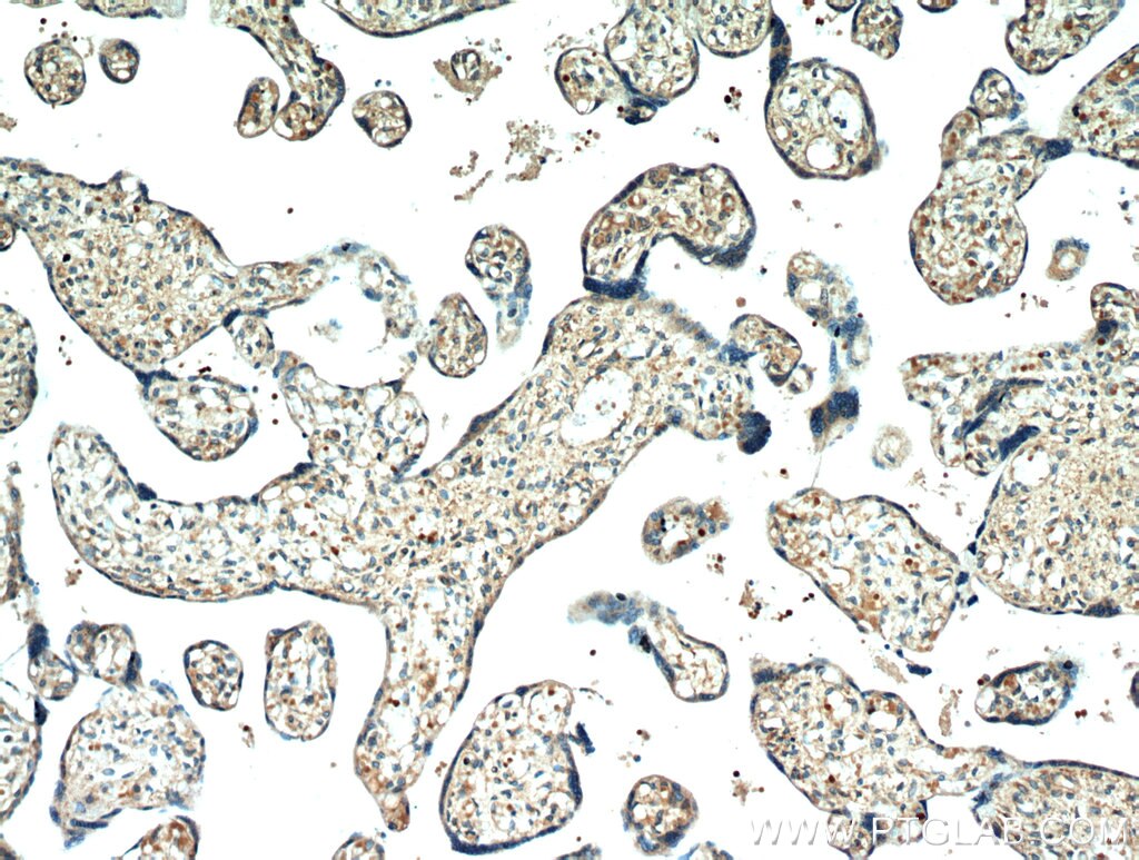 IHC staining of human placenta using 20807-1-AP