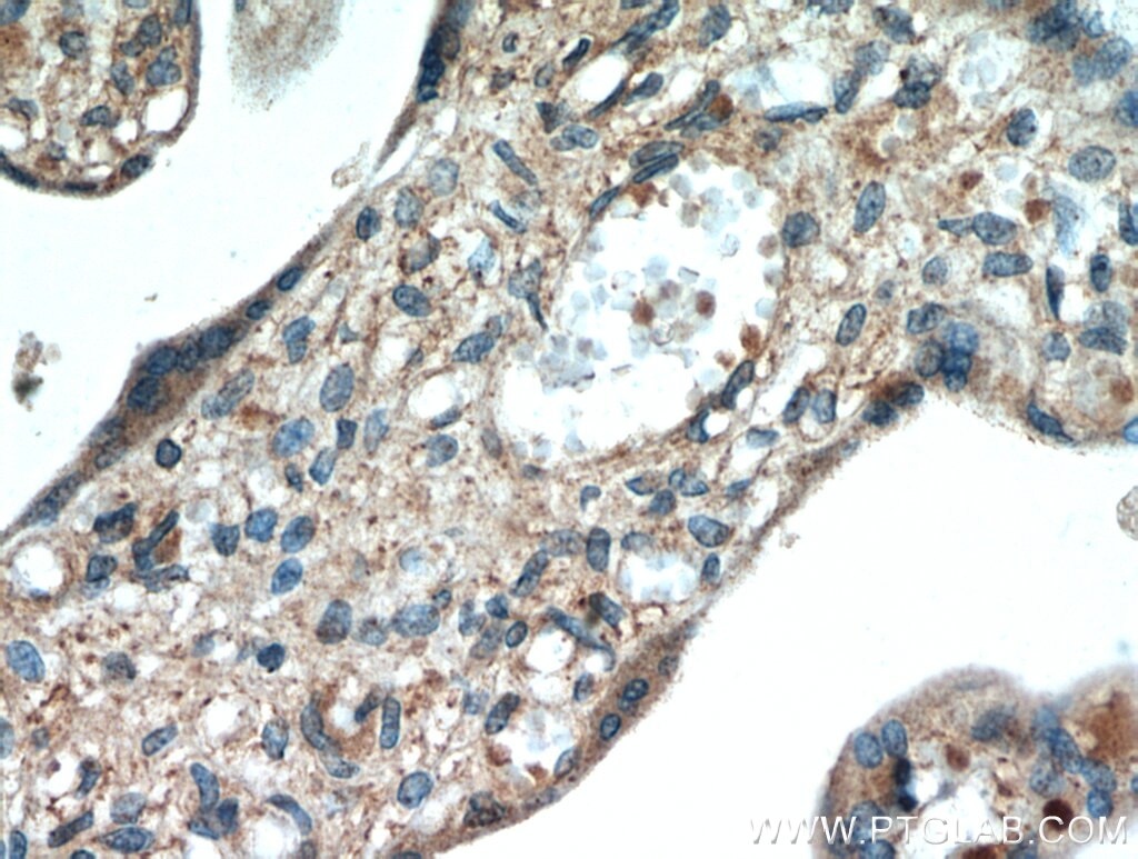 IHC staining of human placenta using 20807-1-AP