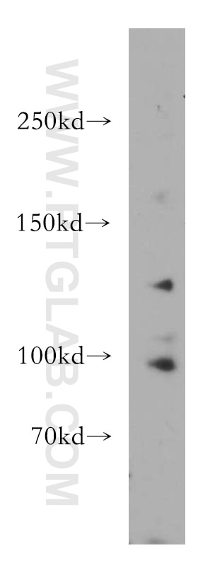 WB analysis of HEK-293 using 11875-1-AP