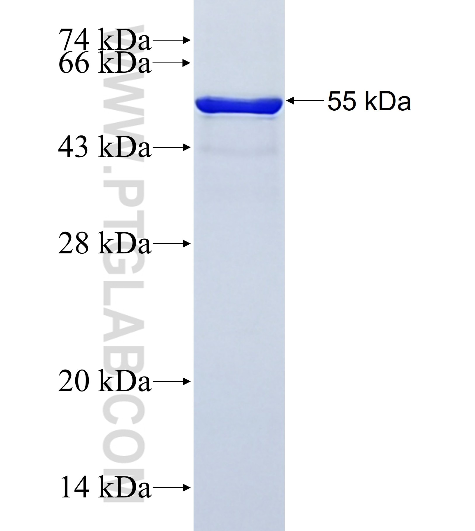 NAV3 fusion protein Ag41576 SDS-PAGE NAV3 fusion protein Ag41576 SDS-PAGE