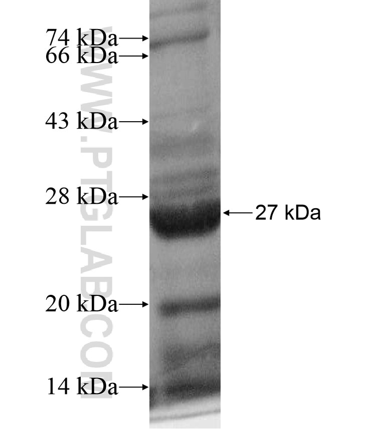 NB-3 fusion protein Ag17412 SDS-PAGE