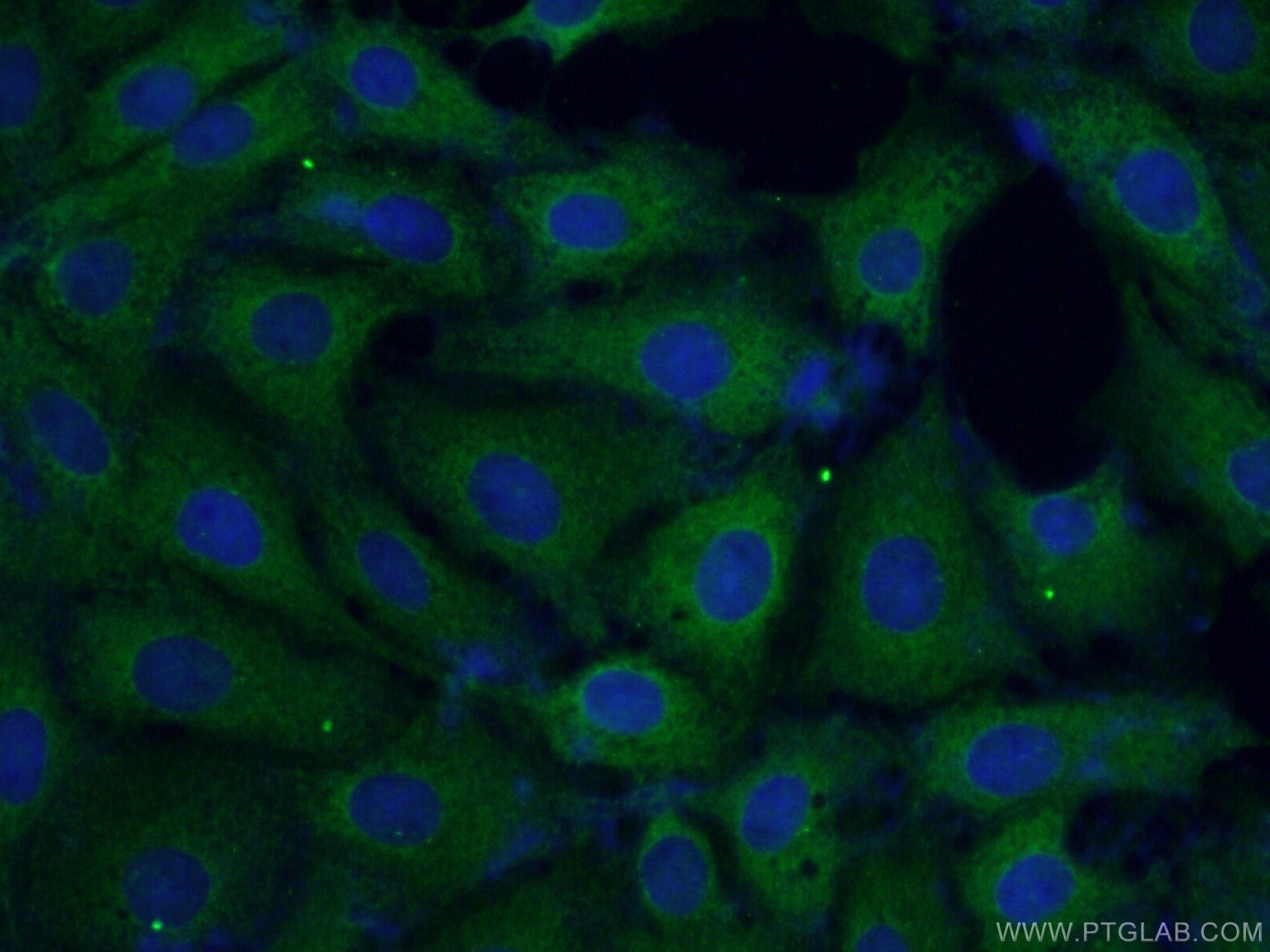 Immunofluorescence (IF) / fluorescent staining of SH-SY5Y cells using NBAS Polyclonal antibody (14683-1-AP)