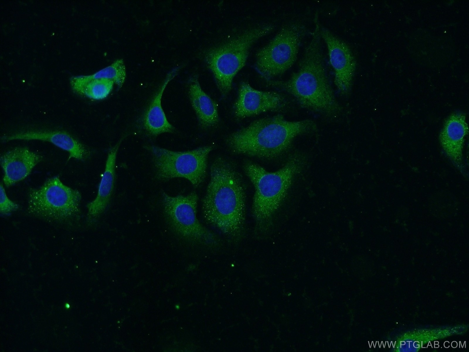 IF Staining of SH-SY5Y using 14683-1-AP