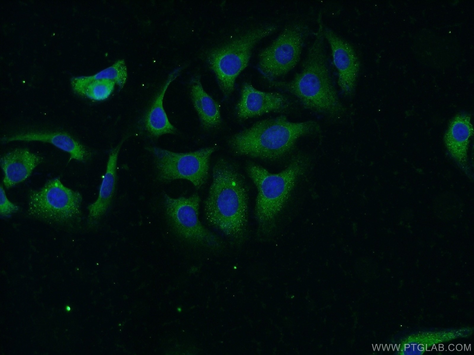 Immunofluorescence (IF) / fluorescent staining of SH-SY5Y cells using NBAS Polyclonal antibody (14683-1-AP)