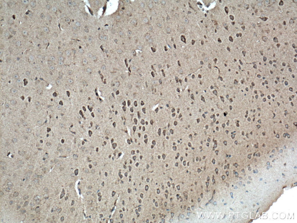 Immunohistochemistry (IHC) staining of mouse brain tissue using NBAS Polyclonal antibody (14683-1-AP)