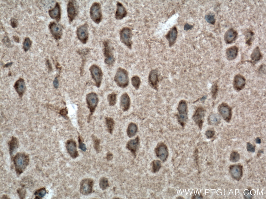 Immunohistochemistry (IHC) staining of mouse brain tissue using NBAS Polyclonal antibody (14683-1-AP)