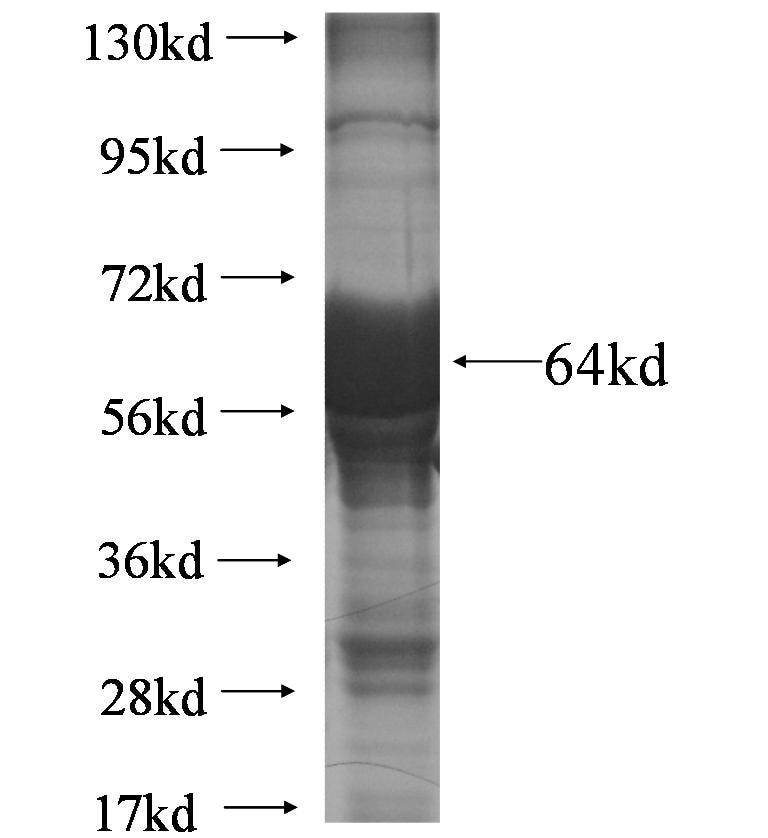 NBAS fusion protein Ag6407 SDS-PAGE