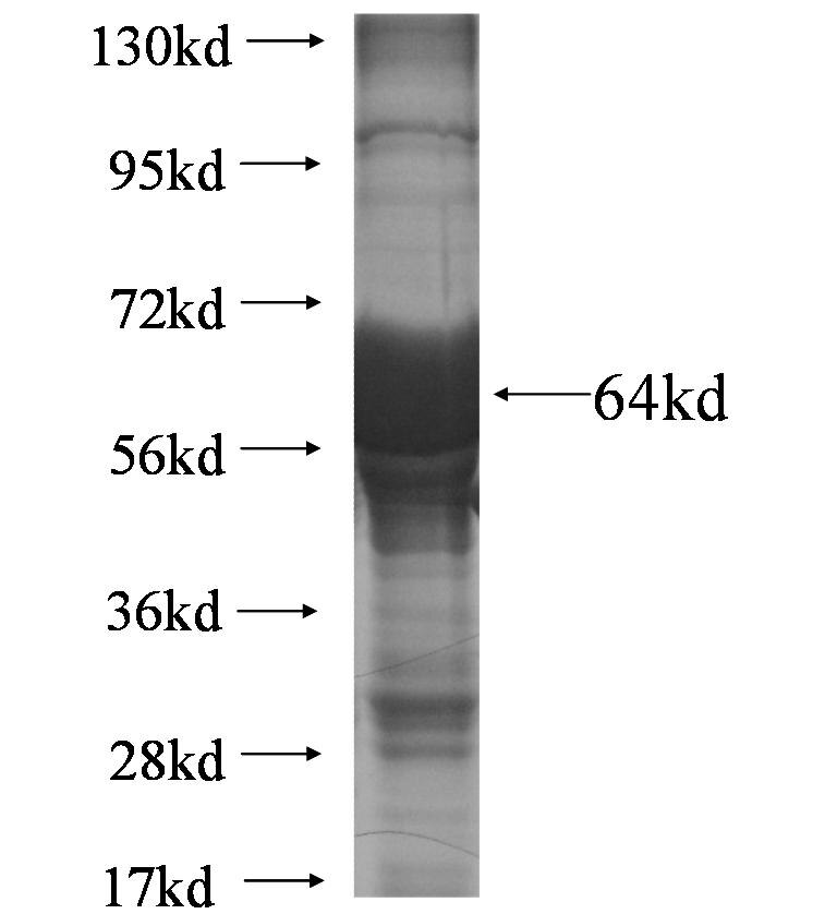 NBAS fusion protein Ag6407 SDS-PAGE