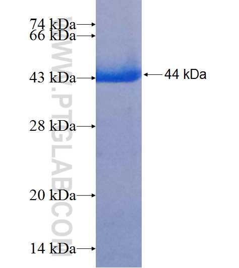 NBAS fusion protein Ag7727 SDS-PAGE