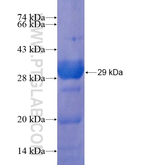 NBEAL1 fusion protein Ag22125 SDS-PAGE