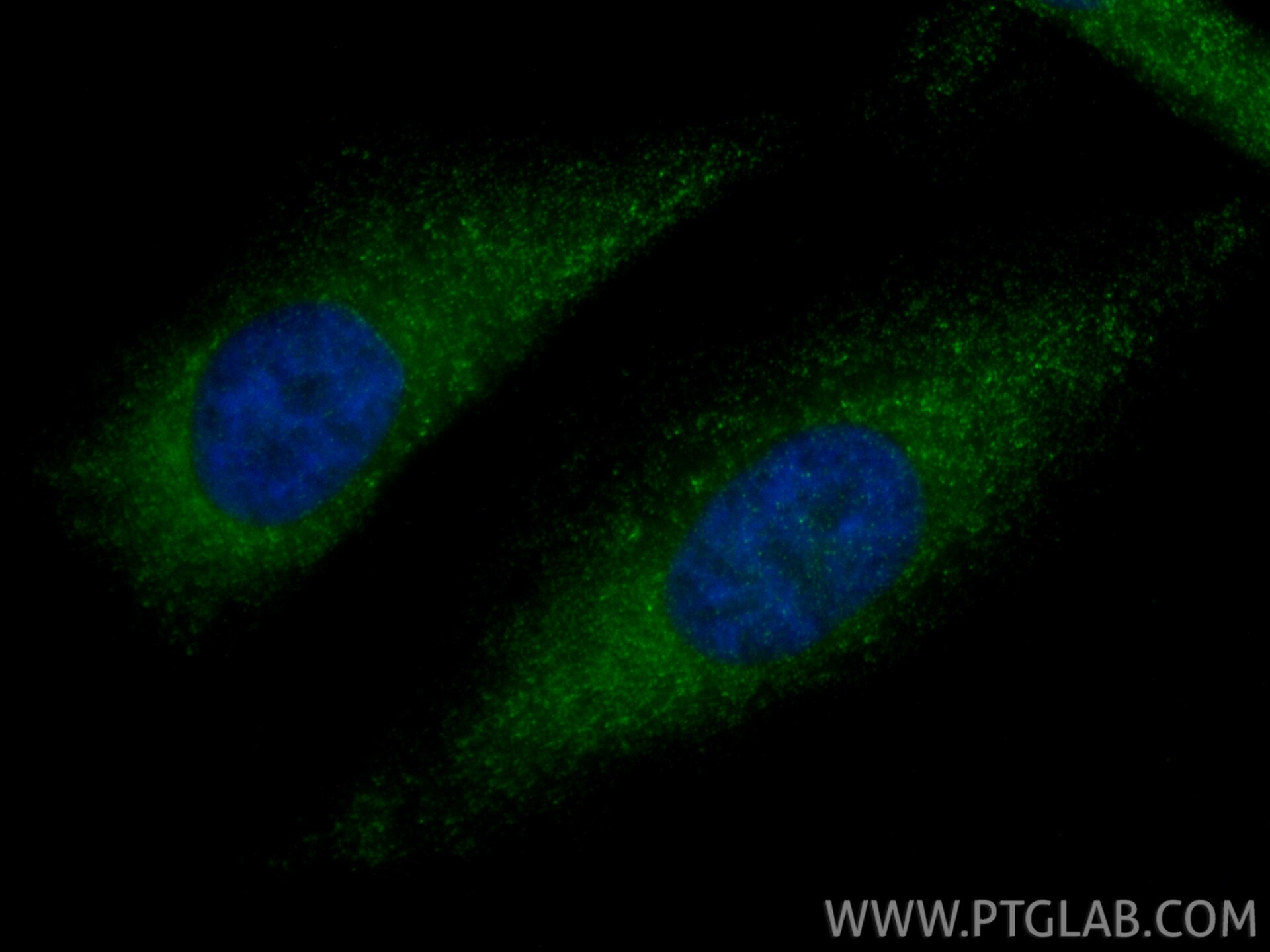 Immunofluorescence (IF) / fluorescent staining of HeLa cells using NBL1 Polyclonal antibody (12069-1-AP)