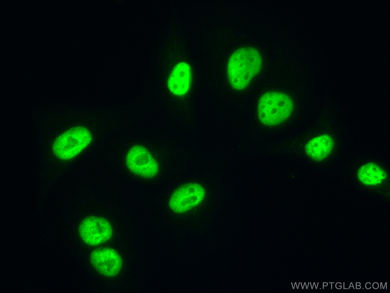 Immunofluorescence (IF) / fluorescent staining of A549 cells using NBS1 Polyclonal antibody (55025-1-AP)