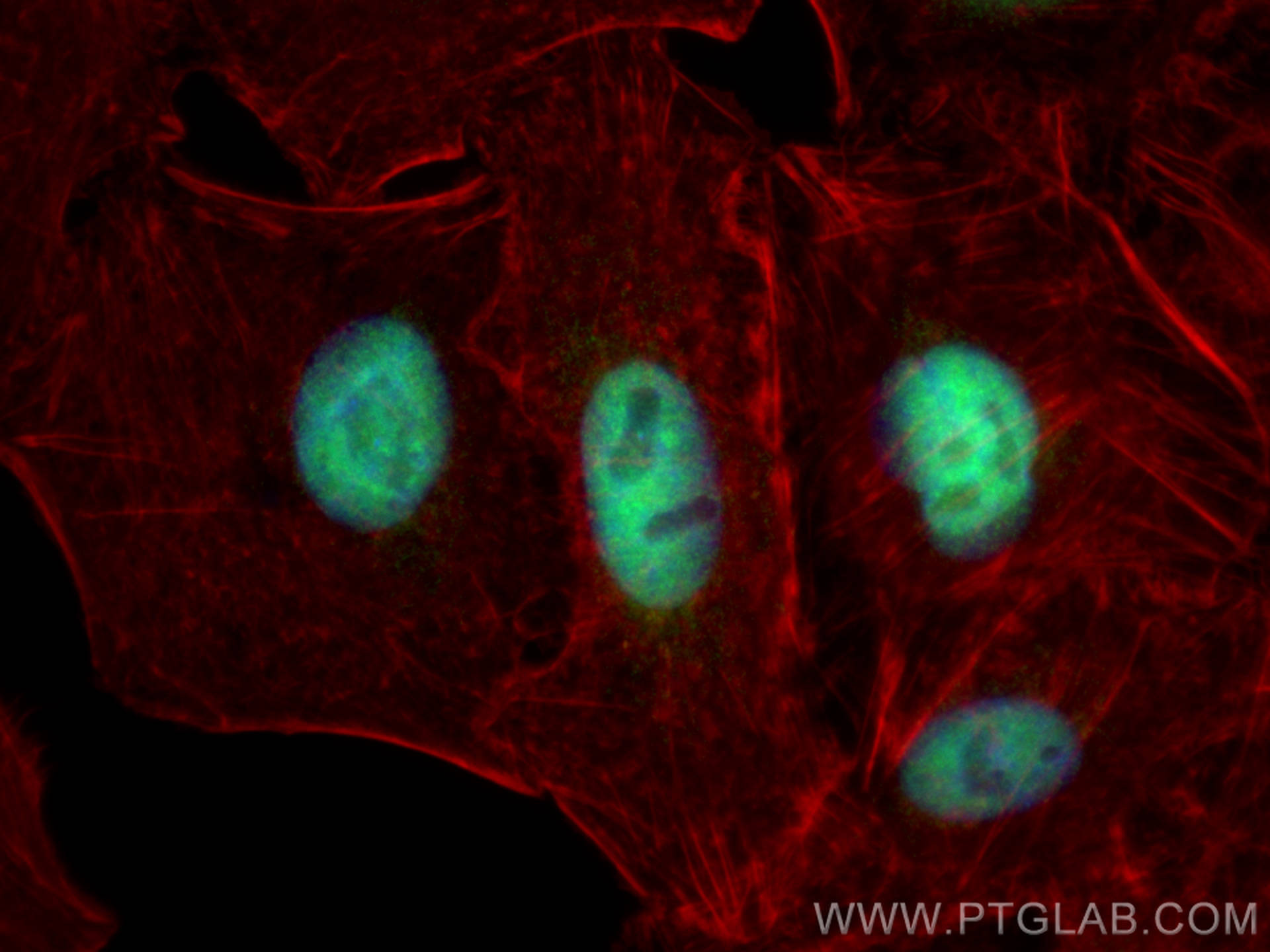 Immunofluorescence (IF) / fluorescent staining of A549 cells using NBN / NBS1 Polyclonal antibody (55025-1-AP)