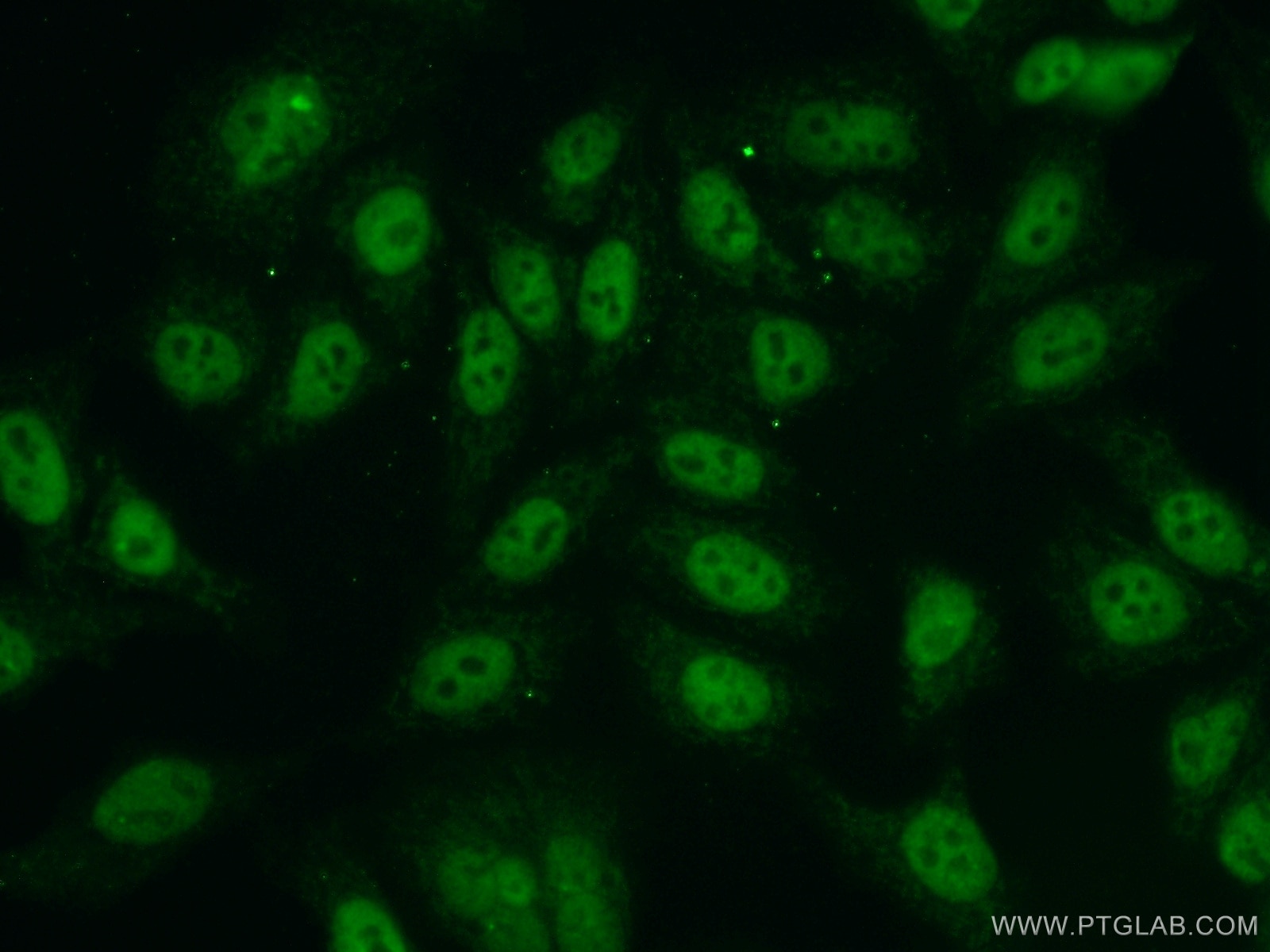 Immunofluorescence (IF) / fluorescent staining of HepG2 cells using NBS1 Polyclonal antibody (55025-1-AP)