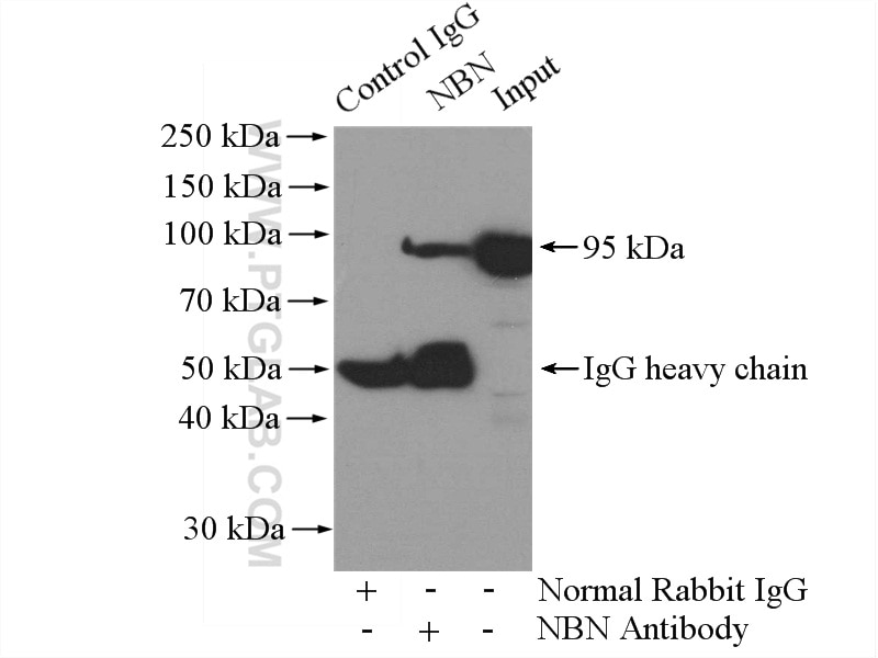 Immunoprecipitation (IP) experiment of HeLa cells using NBS1 Polyclonal antibody (55025-1-AP)