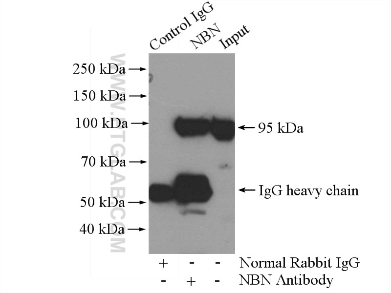 Immunoprecipitation (IP) experiment of HeLa cells using NBS1 Polyclonal antibody (55025-1-AP)