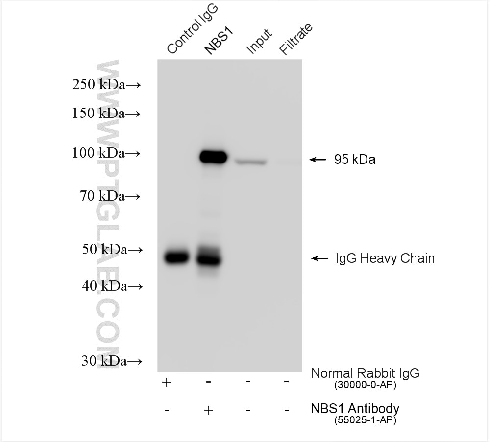 Immunoprecipitation (IP) experiment of HeLa cells using NBS1 Polyclonal antibody (55025-1-AP)
