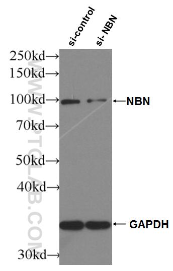 WB analysis of HeLa using 55025-1-AP