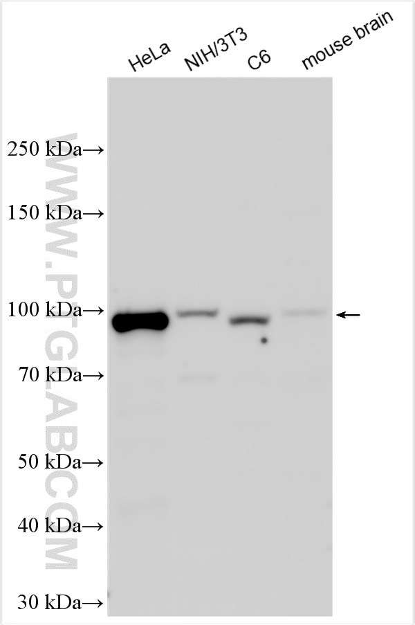 Various lysates were subjected to SDS PAGE followed by western blot with 55025-1-AP (NBS1 antibody) at dilution of 1:3000 incubated at room temperature for 1.5 hours. Western Blot (WB) analysis of various lysates using NBN / NBS1 Polyclonal antibody (55025-1-AP)