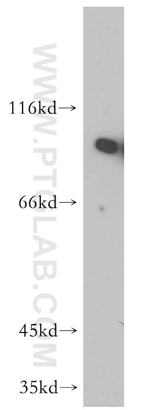 Western Blot (WB) analysis of mouse brain tissue using NBS1 Polyclonal antibody (55025-1-AP)