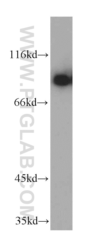 Western Blot (WB) analysis of human testis tissue using NBS1 Polyclonal antibody (55025-1-AP)