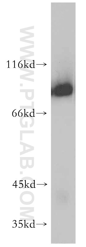 Western Blot (WB) analysis of human testis tissue using NBS1 Polyclonal antibody (55025-1-AP)