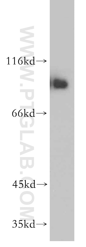 Western Blot (WB) analysis of HeLa cells using NBS1 Polyclonal antibody (55025-1-AP)