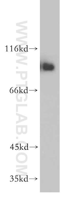 WB analysis of HeLa using 55025-1-AP