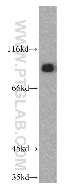 Western Blot (WB) analysis of HepG2 cells using NBS1 Polyclonal antibody (55025-1-AP)