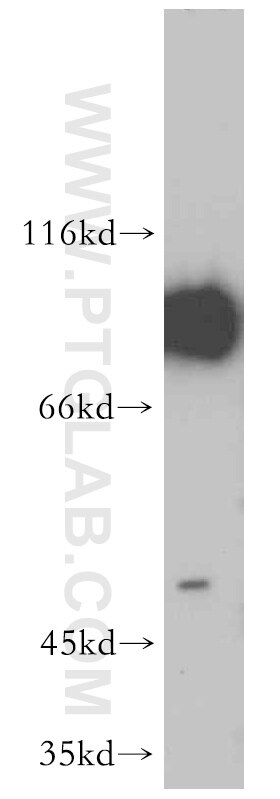 Western Blot (WB) analysis of HepG2 cells using NBS1 Polyclonal antibody (55025-1-AP)