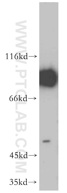 Western Blot (WB) analysis of HepG2 cells using NBS1 Polyclonal antibody (55025-1-AP)