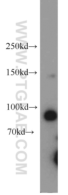 Western Blot (WB) analysis of HeLa cells using NBS1 Polyclonal antibody (55025-1-AP)
