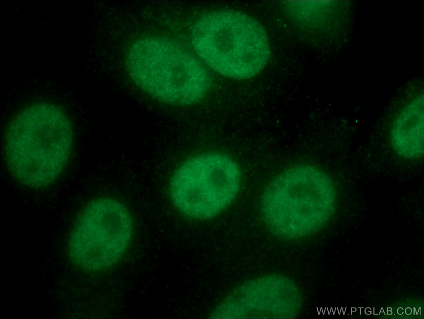 Immunofluorescence (IF) / fluorescent staining of HepG2 cells using NBN Monoclonal antibody (66980-1-Ig)