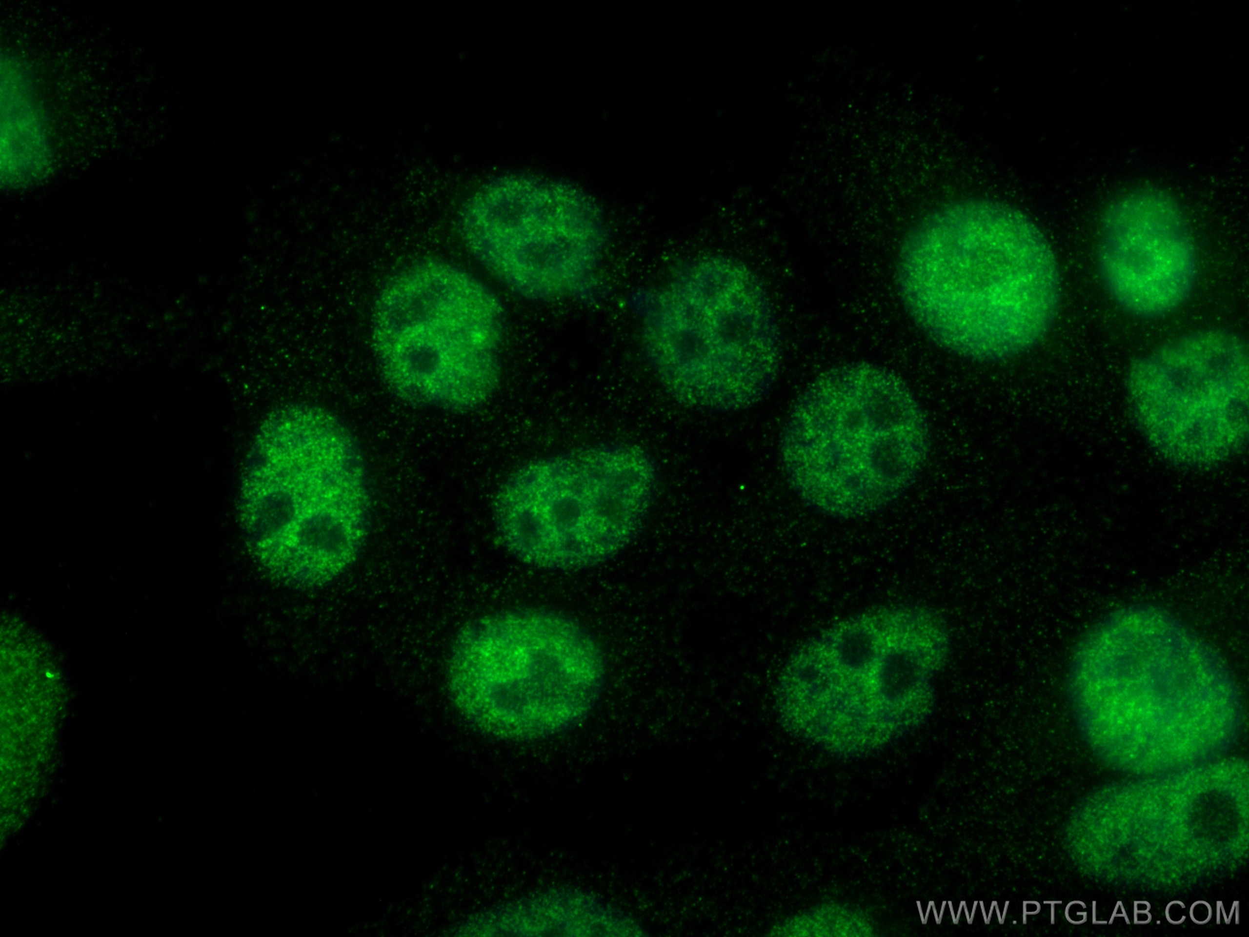 Immunofluorescence (IF) / fluorescent staining of HepG2 cells using NBN / NBS1 Monoclonal antibody (66980-1-Ig)