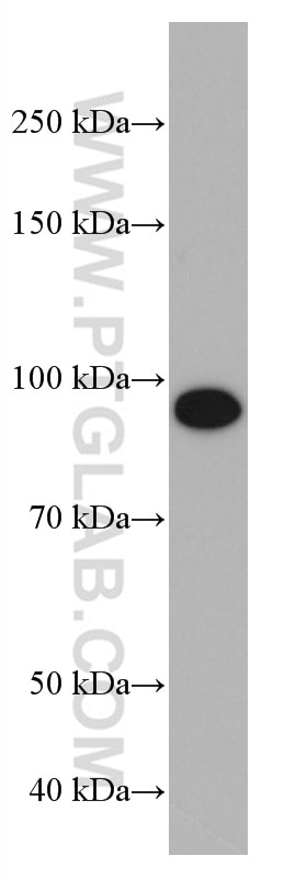 Western Blot (WB) analysis of LNCaP cells using NBN Monoclonal antibody (66980-1-Ig)