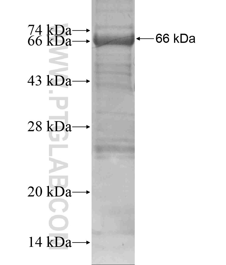 NBN fusion protein Ag17820 SDS-PAGE