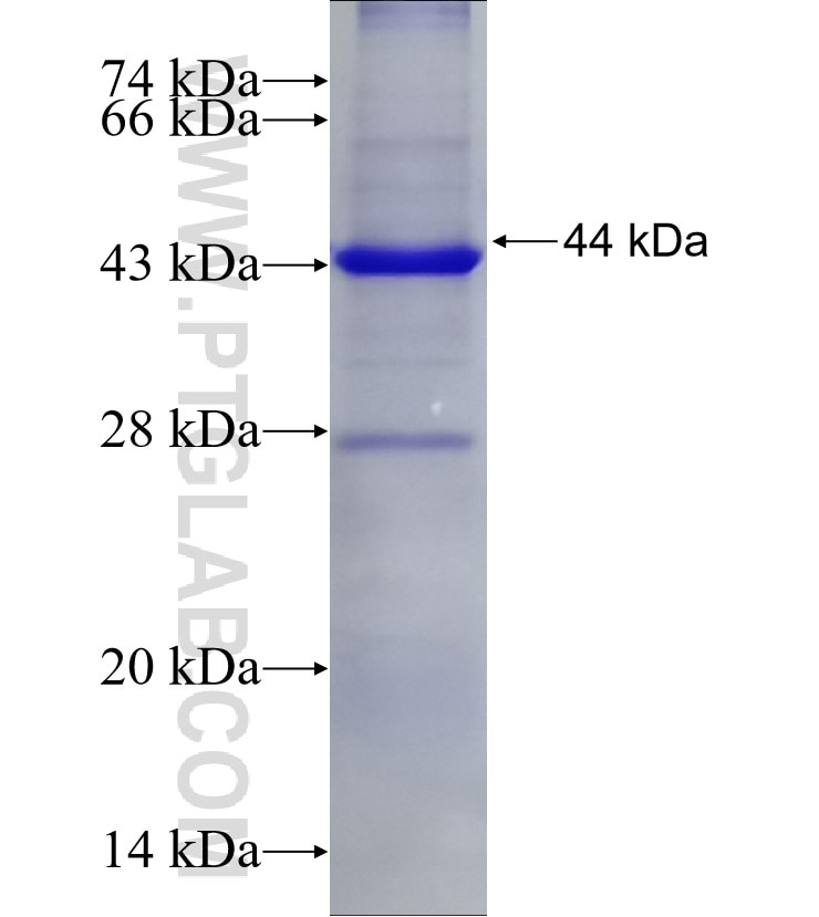 NBN fusion protein Ag19320 SDS-PAGE