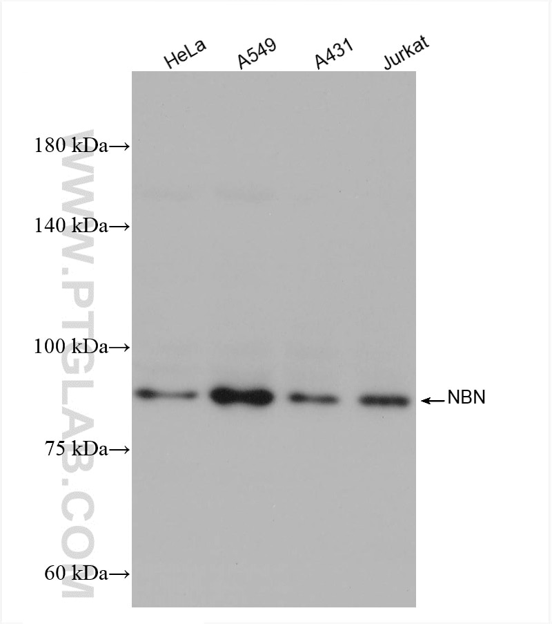 Western Blot (WB) analysis of various lysates using NBN / NBS1 Recombinant antibody (82884-1-RR)