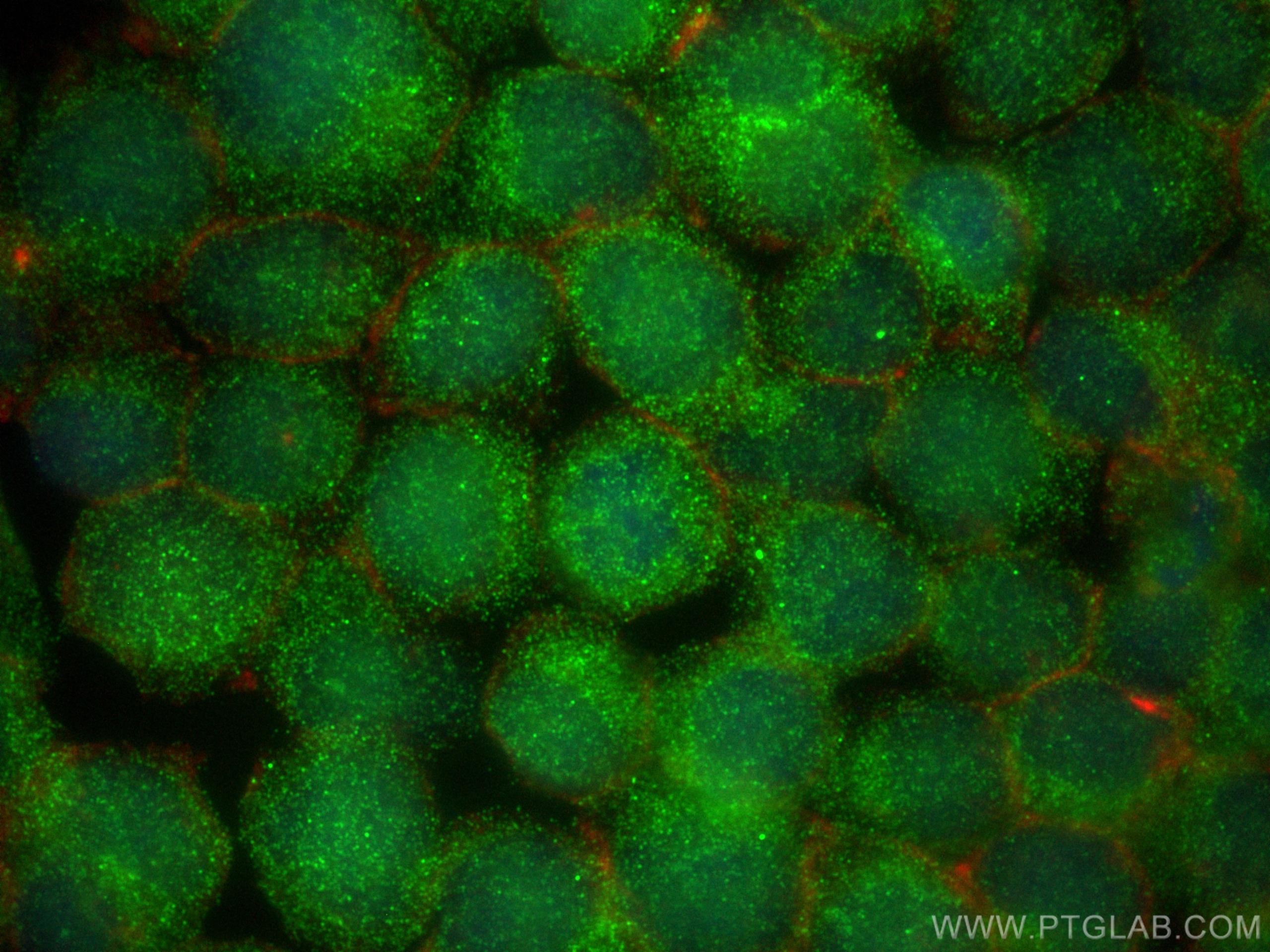 Immunofluorescence (IF) / fluorescent staining of Jurkat cells using NBPF1 Polyclonal antibody (13242-1-AP)