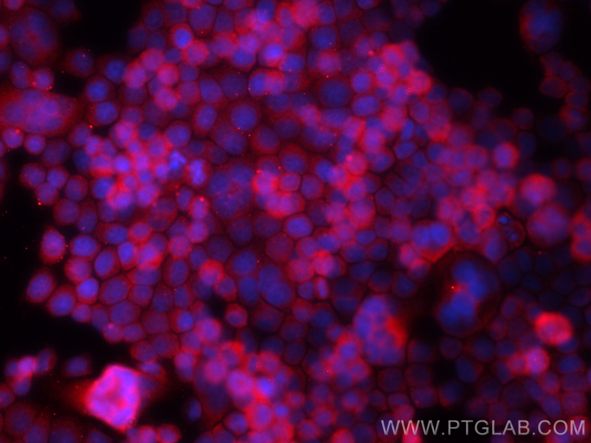 Immunofluorescence (IF) / fluorescent staining of BxPC-3 cells using NBPF1 Polyclonal antibody (13242-1-AP)