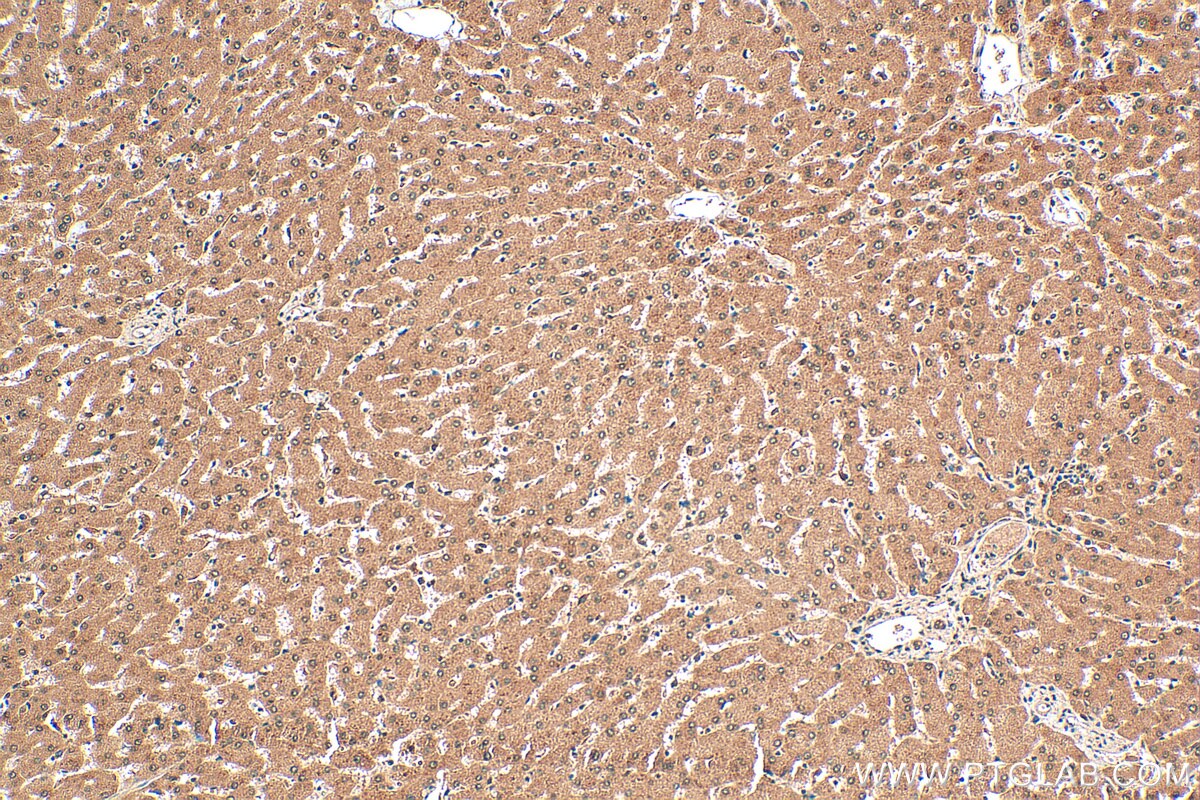 Immunohistochemistry (IHC) staining of human liver tissue using NBPF1 Polyclonal antibody (13242-1-AP)