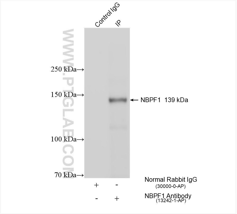 Immunoprecipitation (IP) experiment of HeLa cells using NBPF1 Polyclonal antibody (13242-1-AP)
