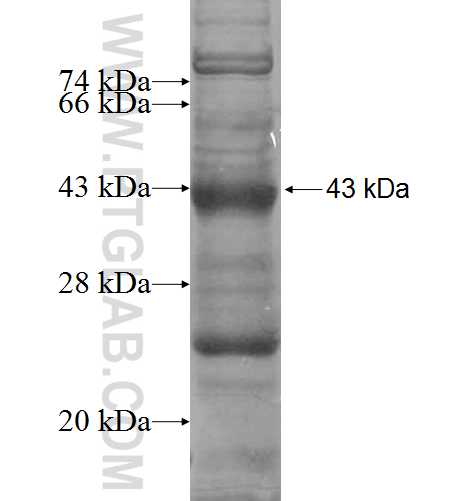 NBPF15 fusion protein Ag3951 SDS-PAGE