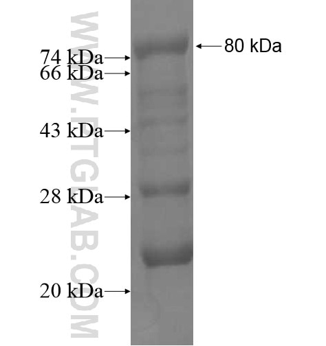 NBPF22P fusion protein Ag11516 SDS-PAGE
